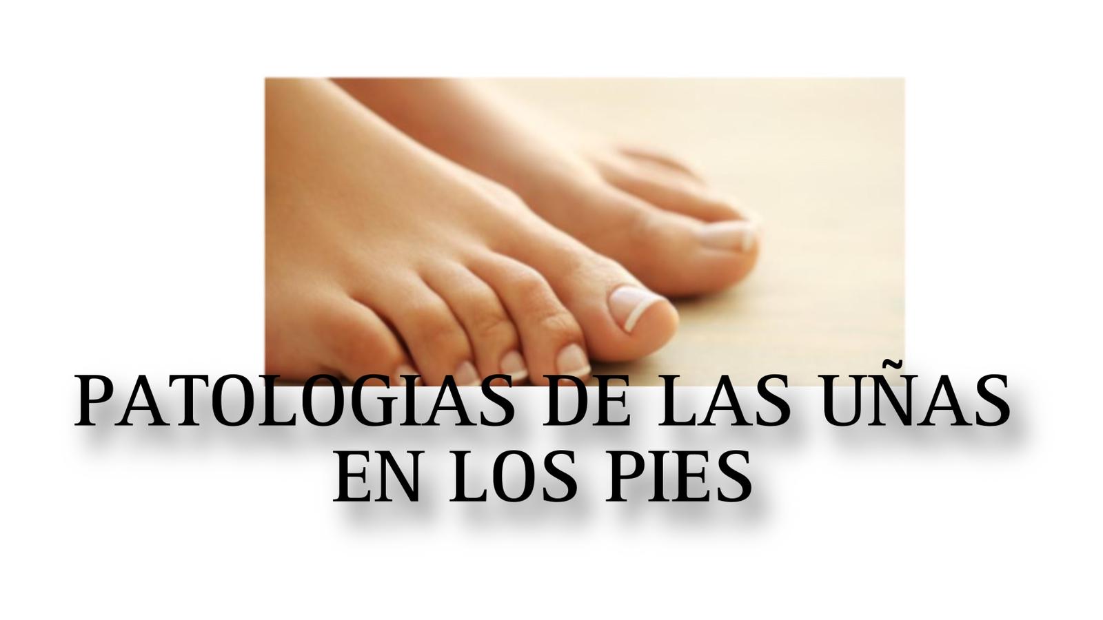 LIBRO PDF 0004 PATOLOGIAS DE LAS UÑAS EN LOS PIES