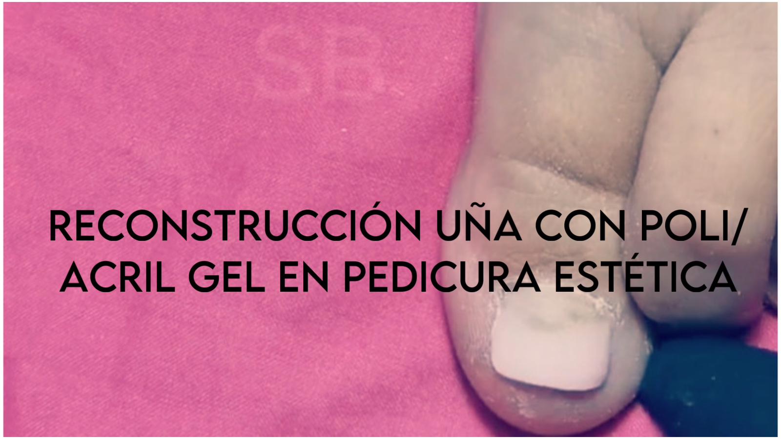 000032 CURSO RECONSTRUCCIÓN UÑA CON POLI/ ACRIL GEL EN PEDICURA ESTÉTICA